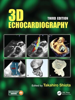 cover image of 3D Echocardiography